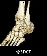 骨3DCT