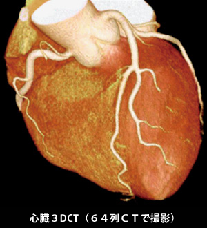 心臓3DCT(64列CTで撮影)