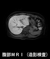 腹部MRI(造影検査)