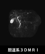 胆道系3DMRI