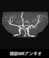 頭部MRアンギオ